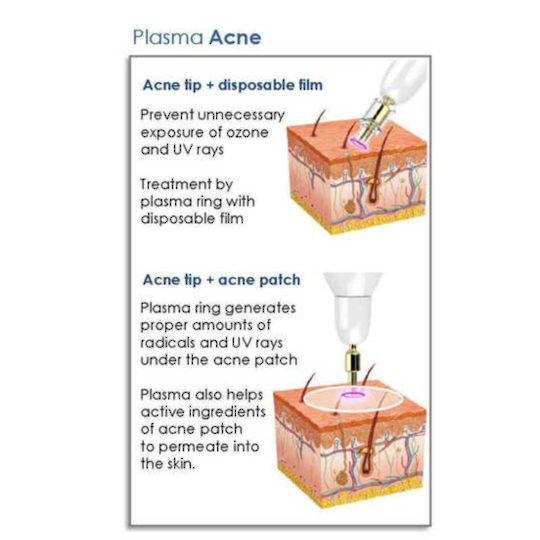 Plamere Plasma Fibroblast (Incl training & starter kit) + BONUS $500 of Serums image 5